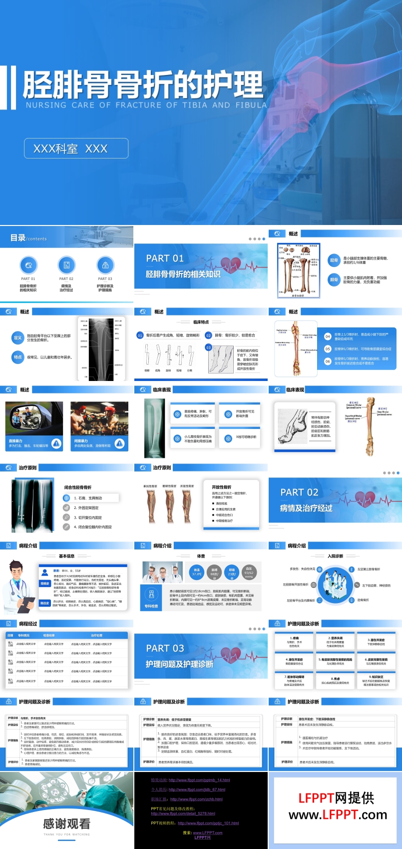 脛腓骨骨折的護(hù)理查房PPT