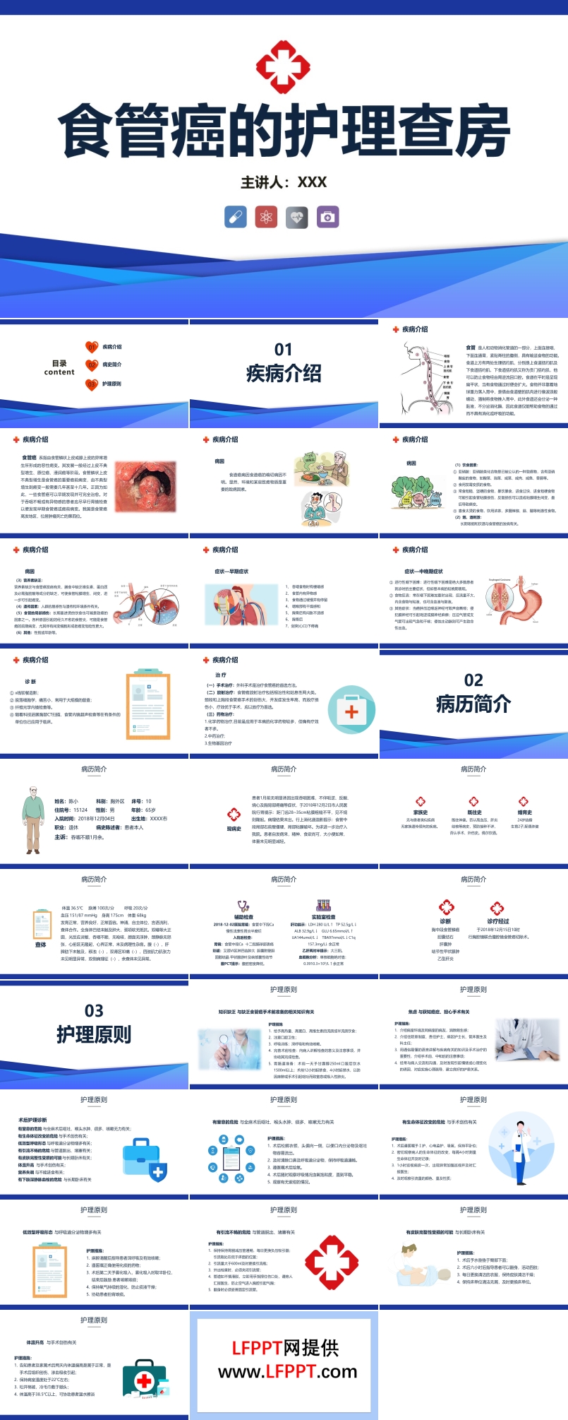 食管癌的護理查房ppt