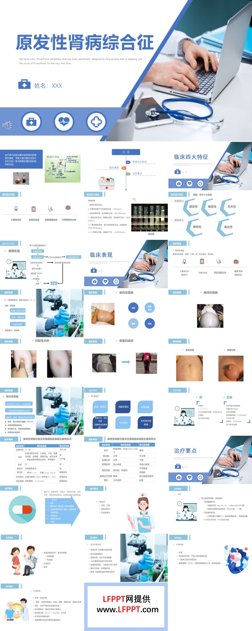 腎病綜合征護(hù)理查房PPT