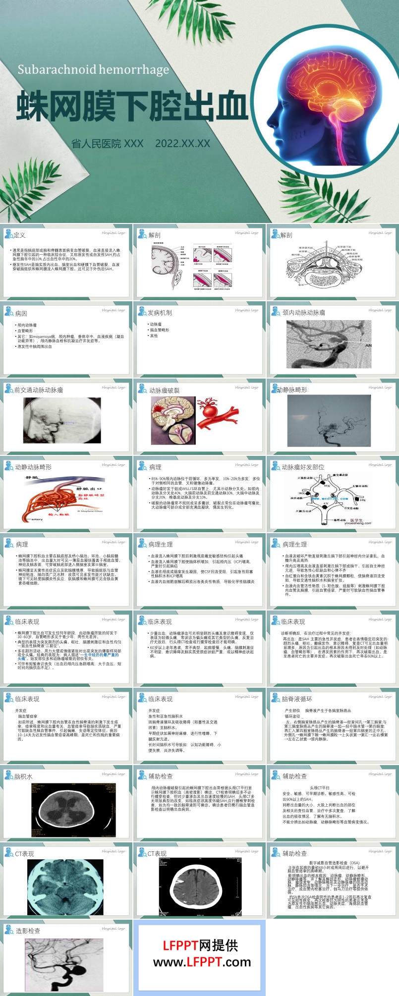 蛛網(wǎng)膜下腔出血PPT